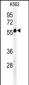 PSMAL Antibody (Center)